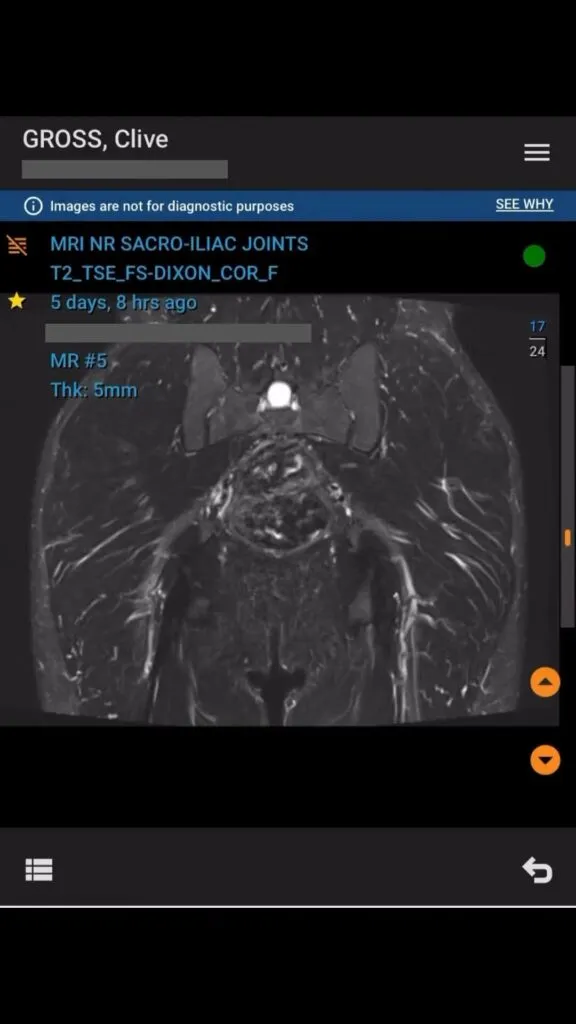 Road to Osaka week 5 training highlights showing Chiron Events feature and injury recovery